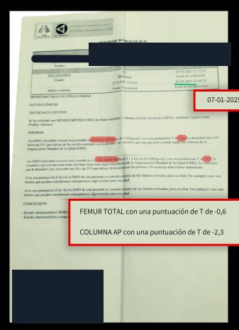 Densitometría anterior
