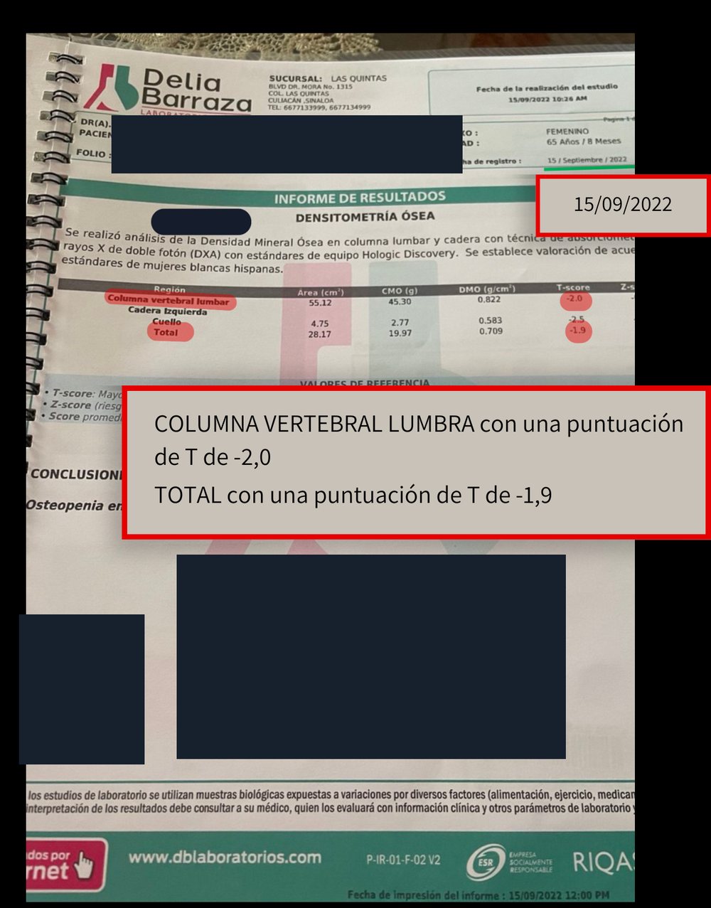 Densitometría anterior