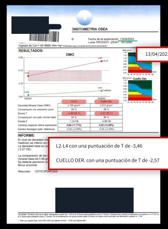 Densitometría anterior