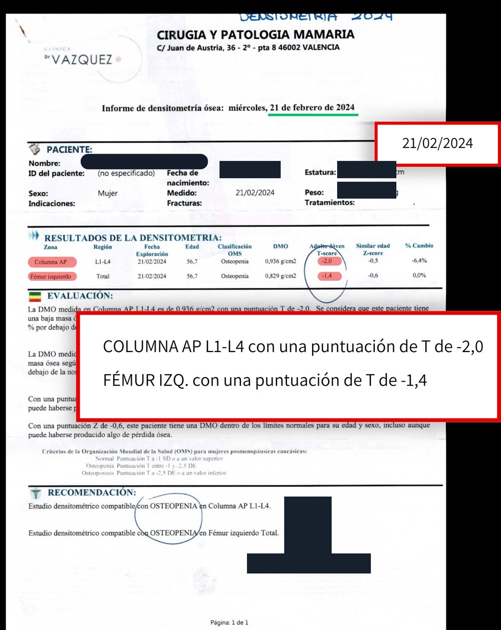 Densitometría anterior