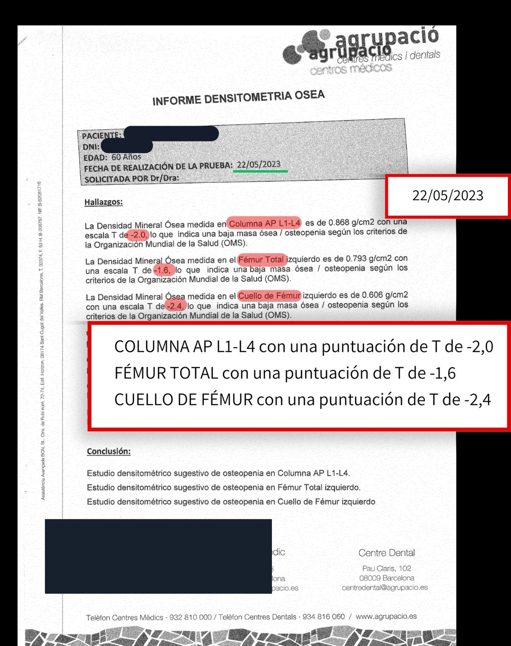Informe de densitometría