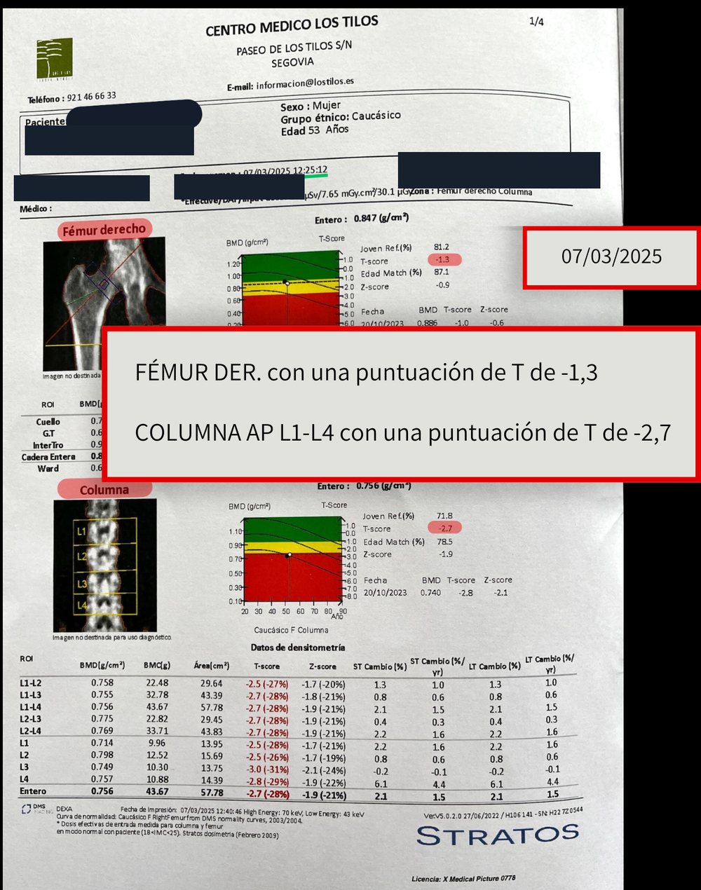Densitometría posterior