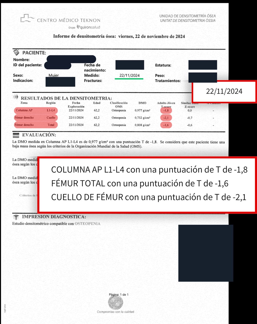 Informe de densitometría