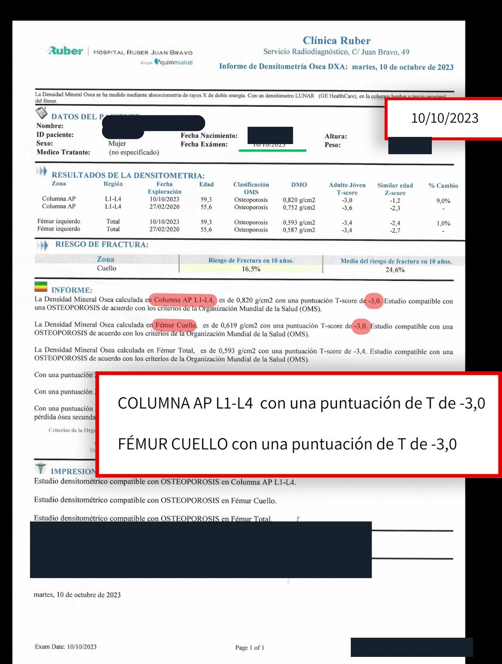 Densitometría anterior