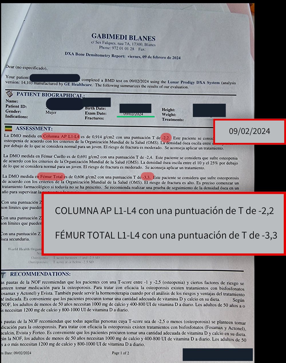 Densitometría anterior
