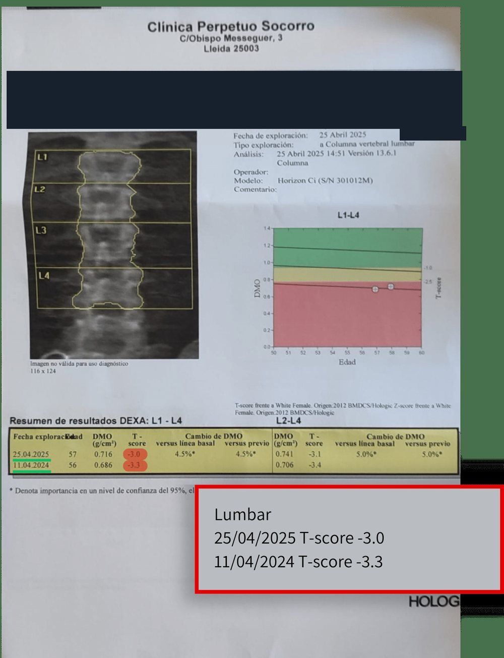 Densitometría anterior