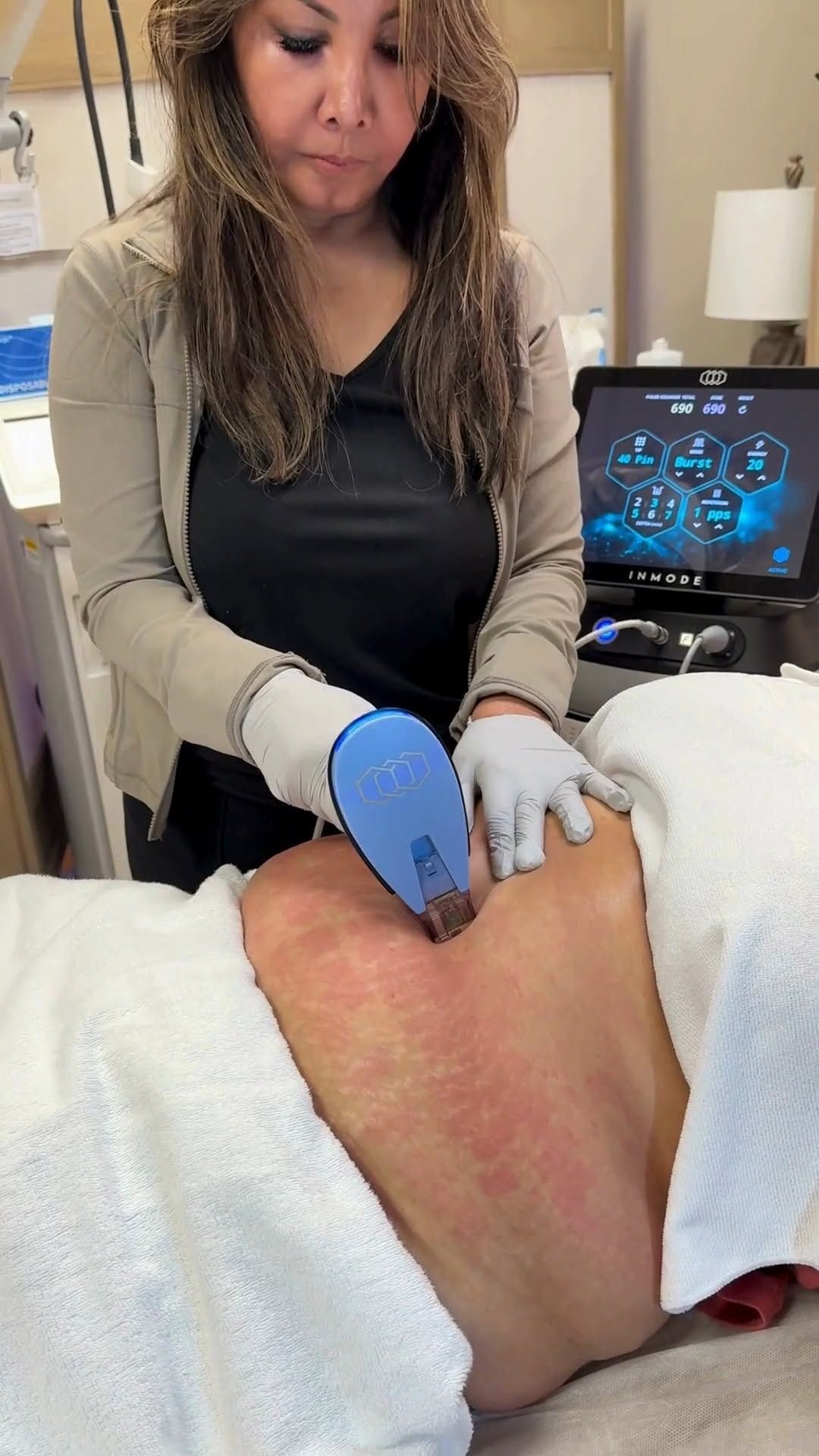 Noemi performing an in-clinic body treatment