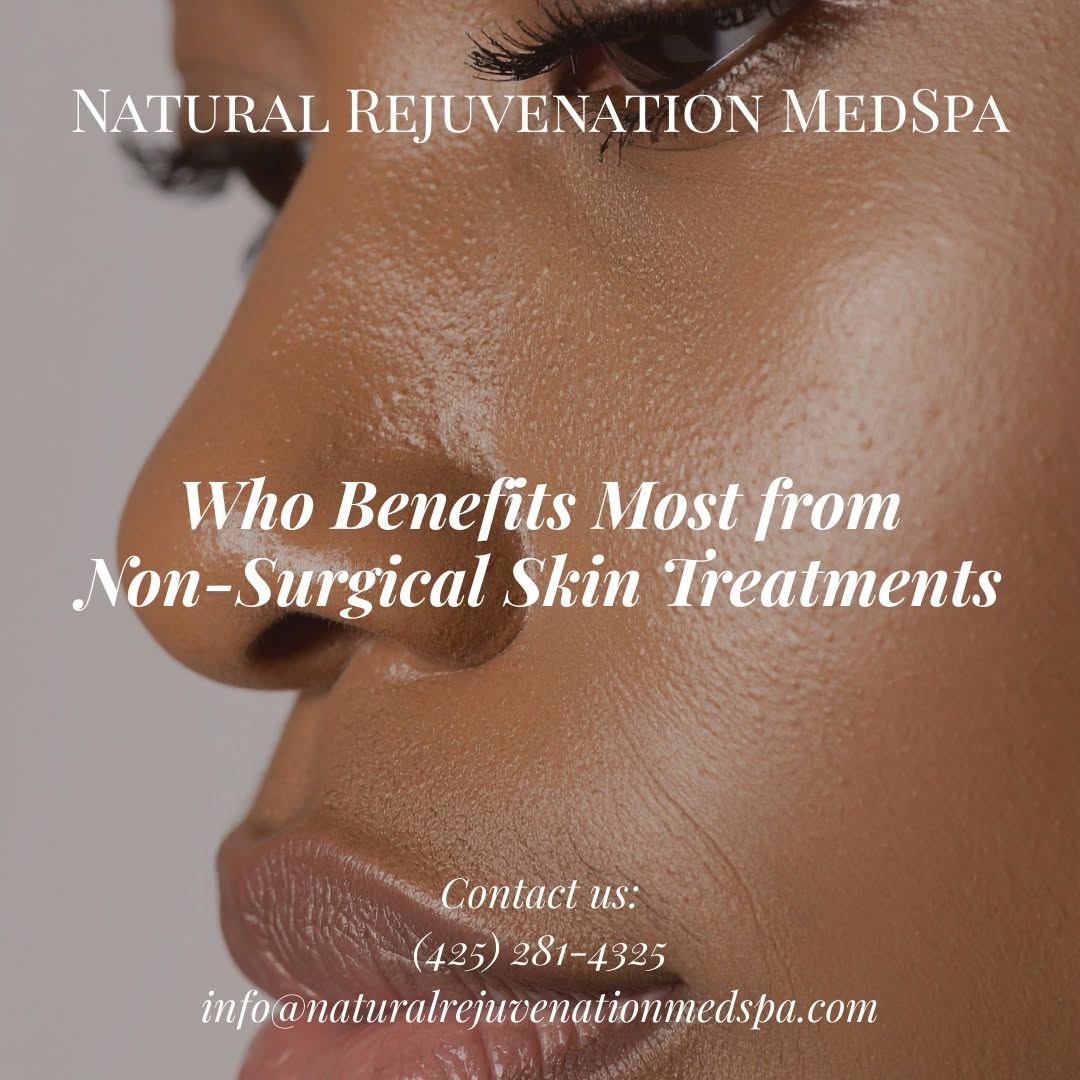 Natural Rejuvenation MedSpa skin treatment feature
