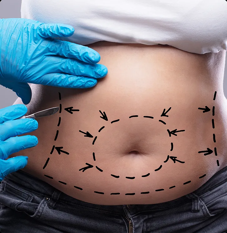 Fat Reduction Treatment