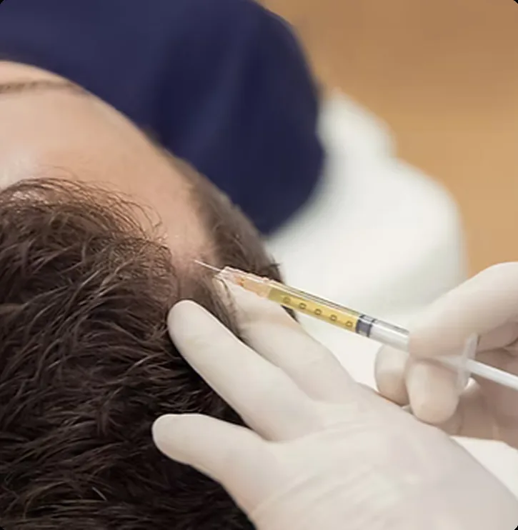 Hair Restoration in Bellevue