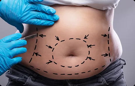 Pigmentation Treatment
