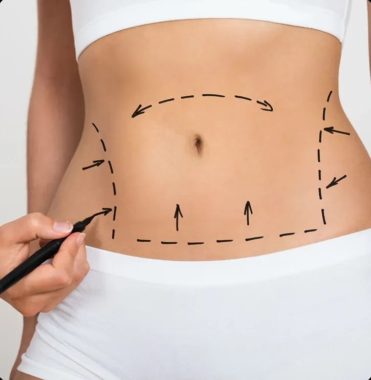 Belly Skin Tightening Treatment