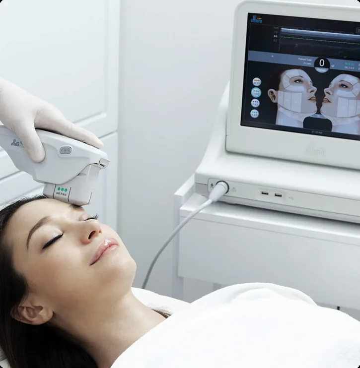 Ultherapy Treatment