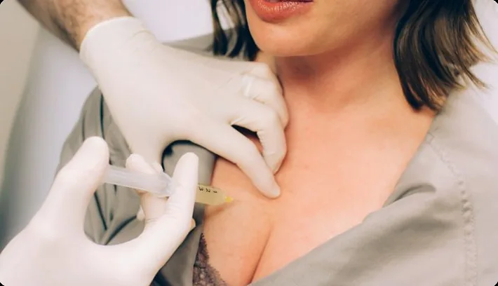 Laser Skin Resurfacing