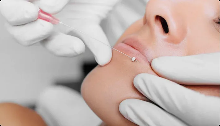Microneedling