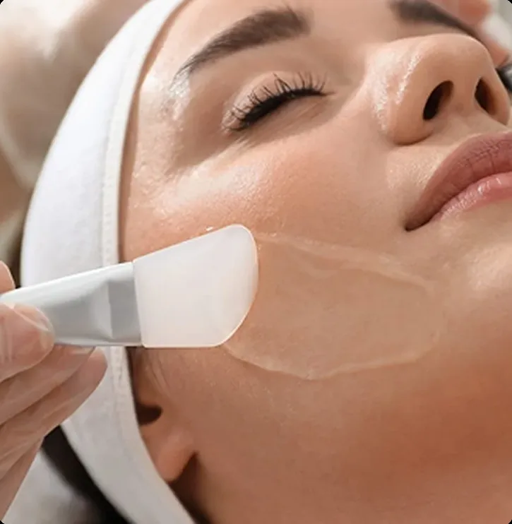 Chemical Peels Treatment