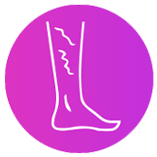 TREAT VARICOSE VEINS