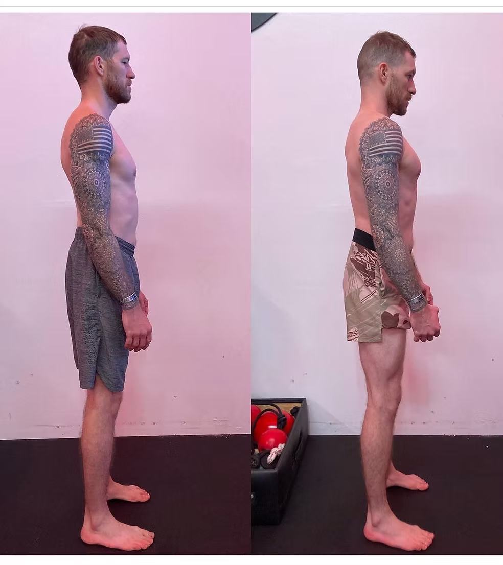 before-after chronic-apin-relief Functional Patterns Minnesota - St Louis Park
