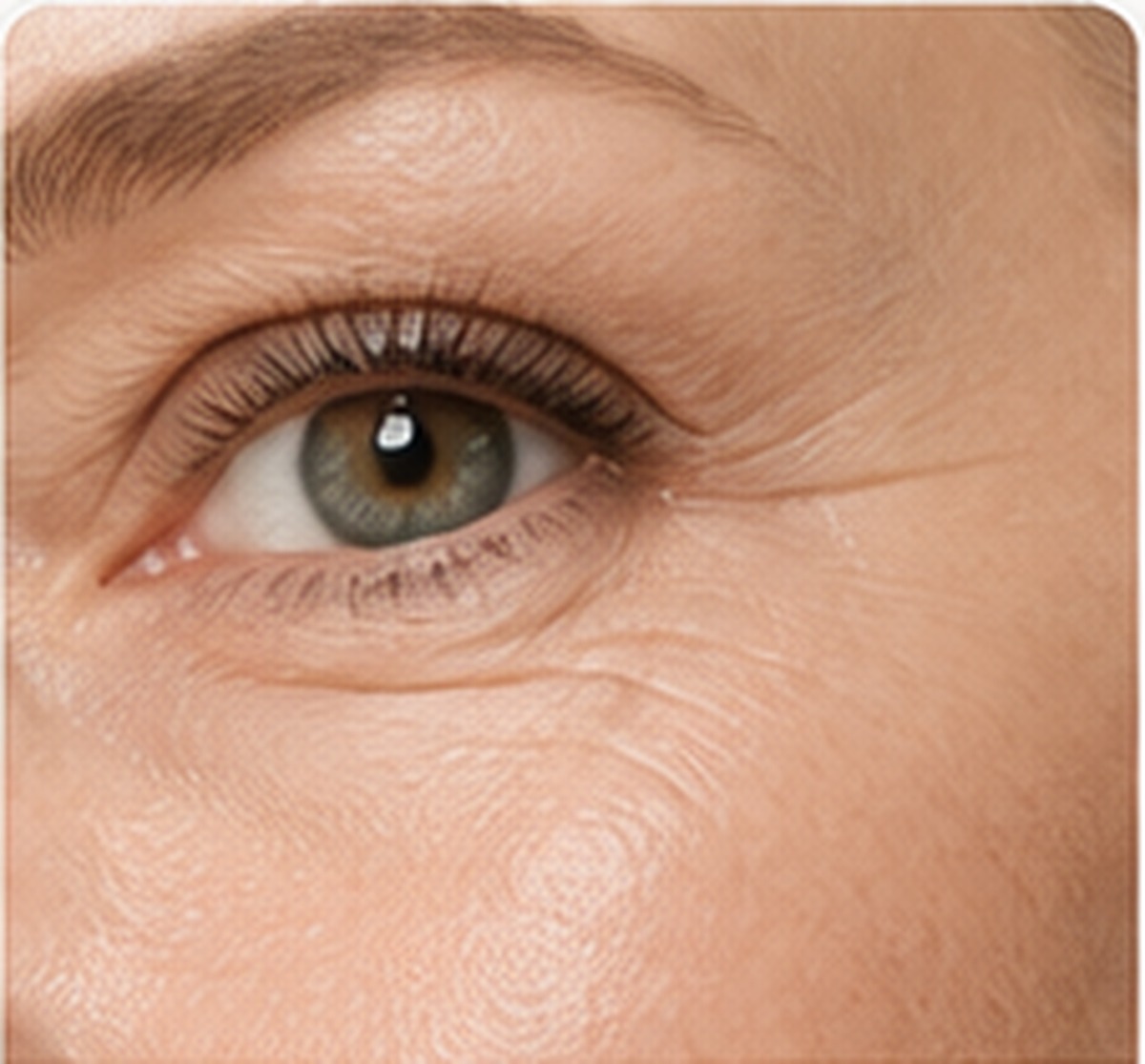 Contorno de ojos con líneas de expresión reales