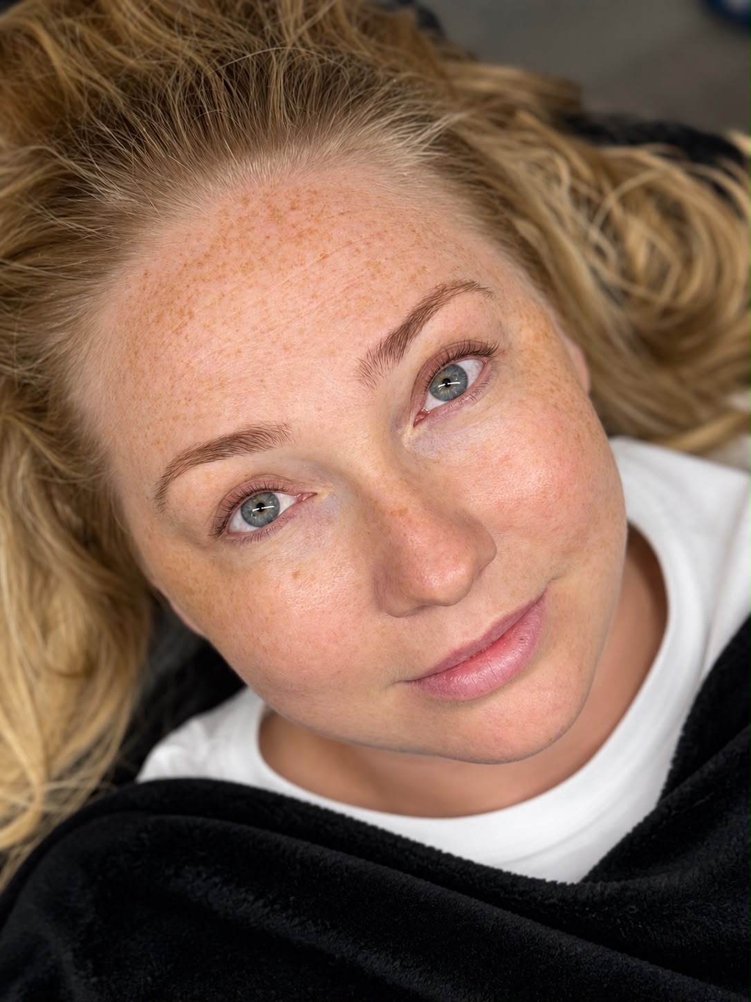 Lash line enhancement result