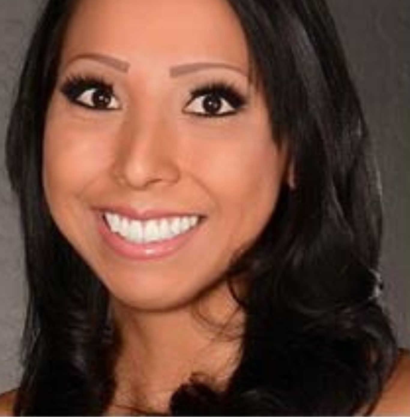 Patient smile after dental implant treatment