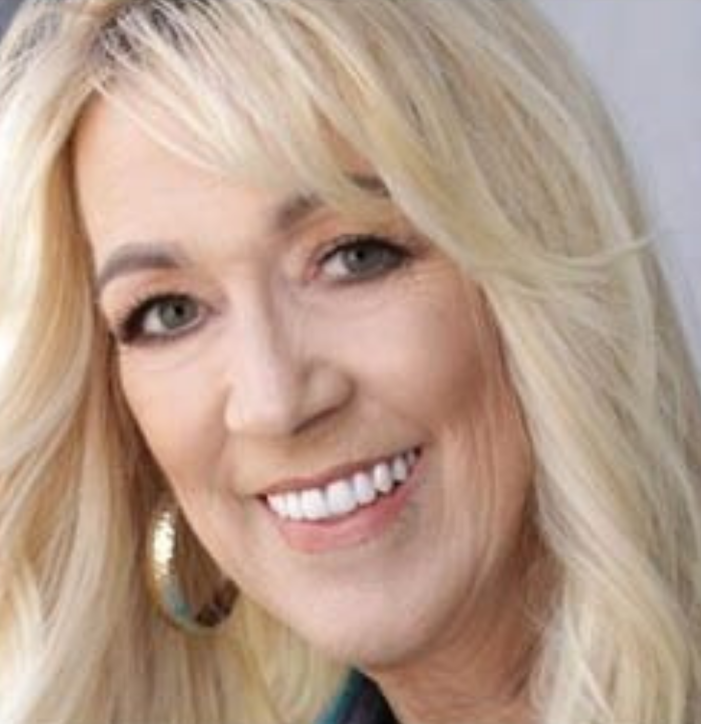 Patient smile after dental implant treatment