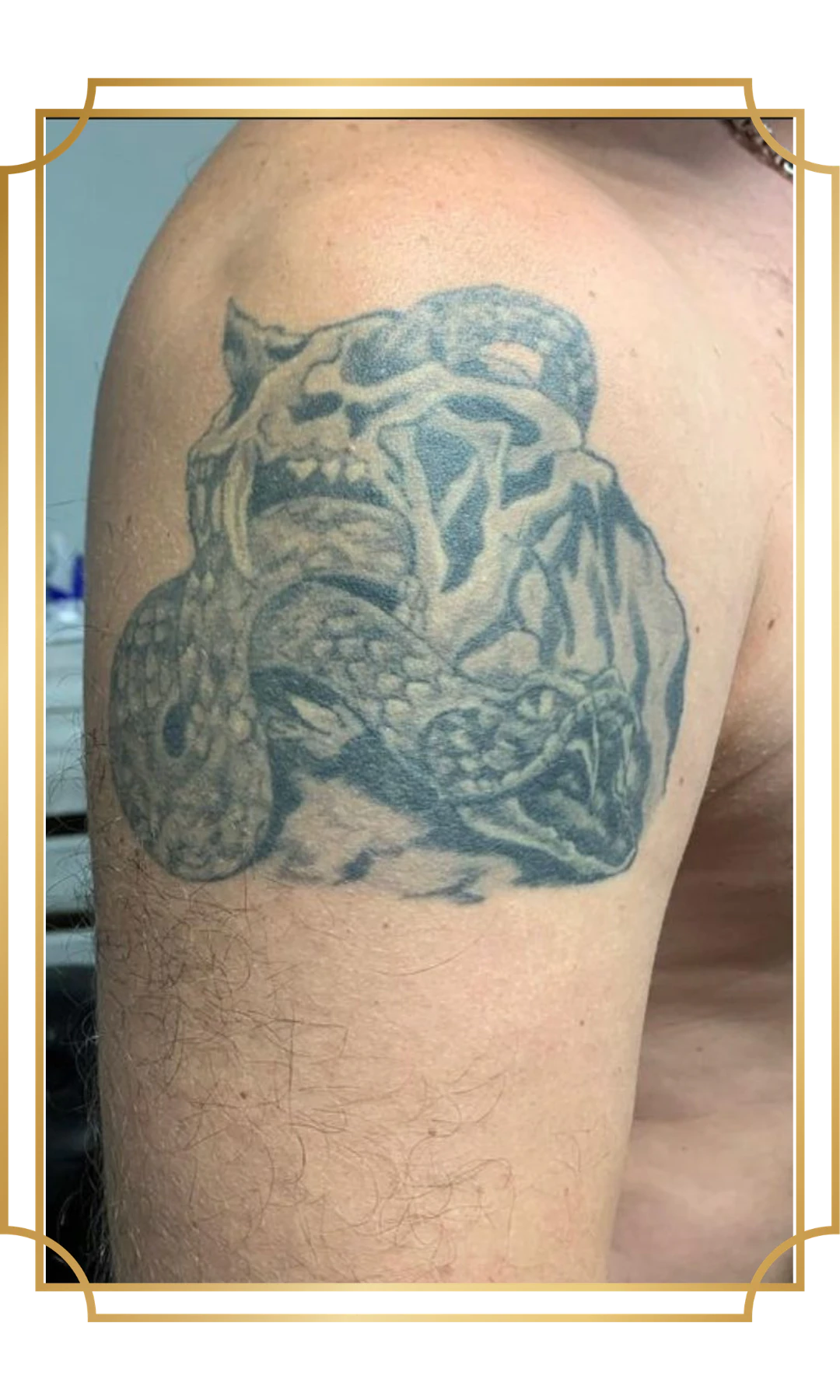 Cover Up tattoo portfolio image 3