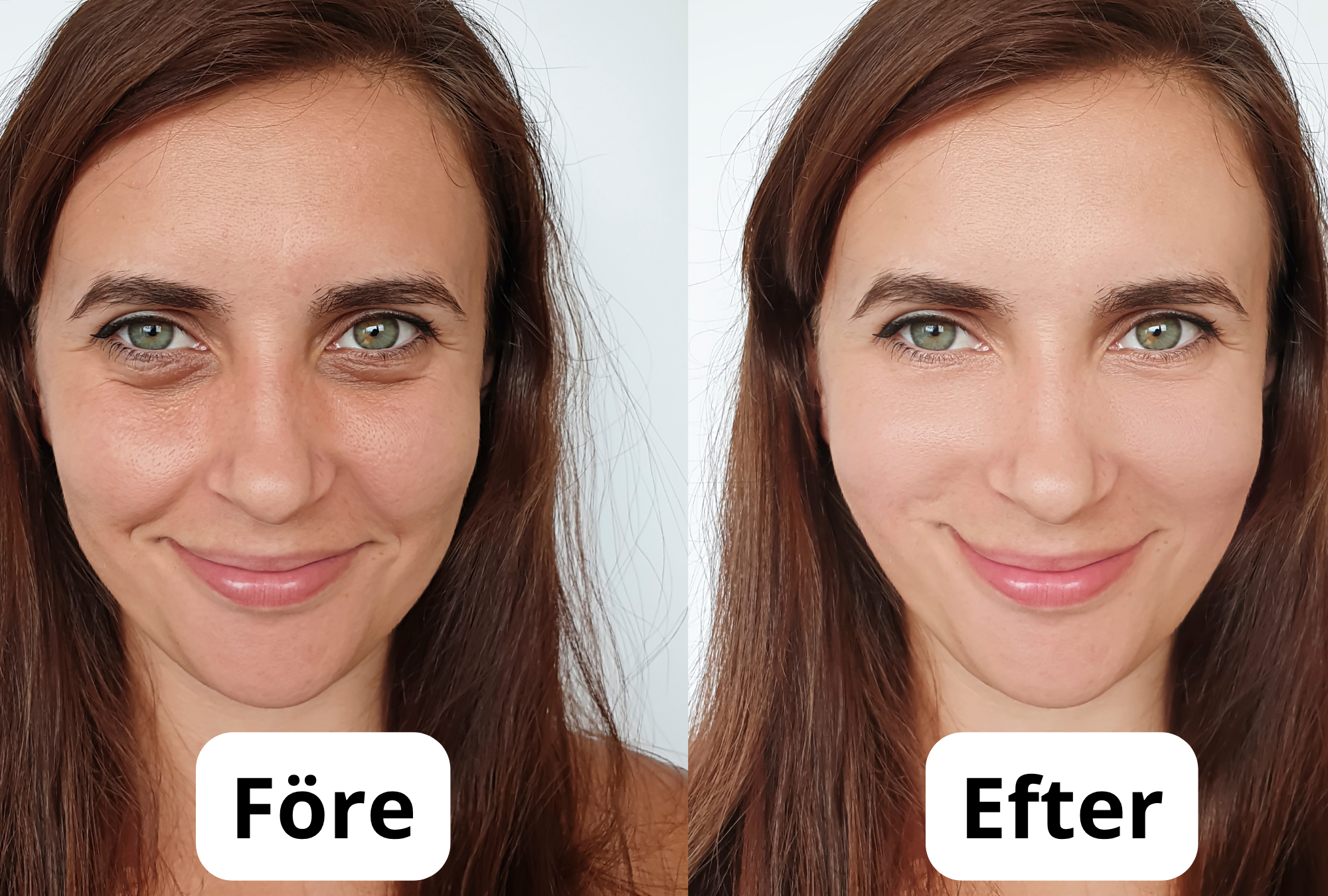 Före och efter hudbehandling
