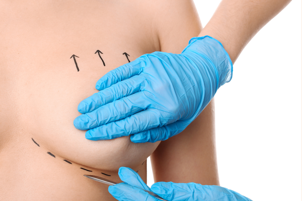 breast implant pre-op