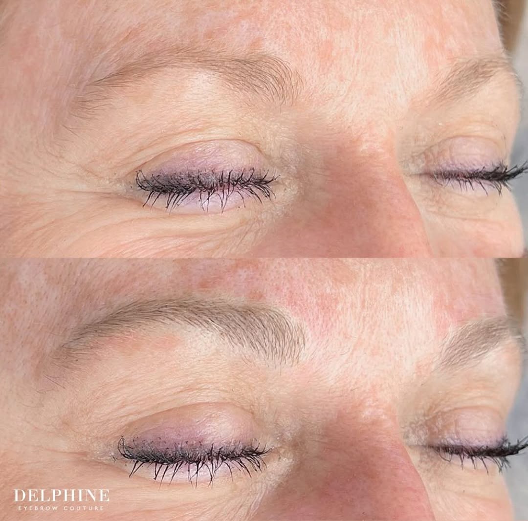 Eyebrow restoration by Delphine, before and after