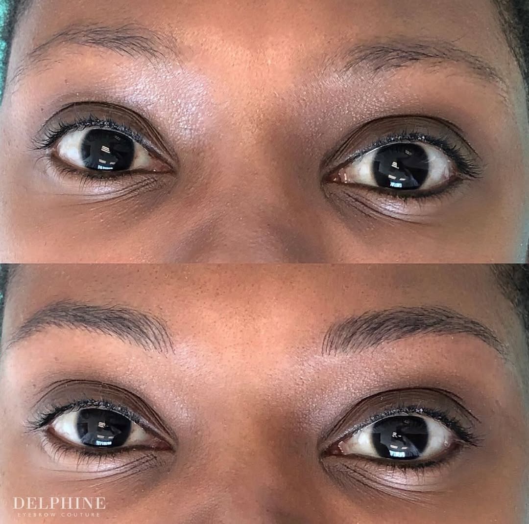 Eyebrow restoration by Delphine, before and after