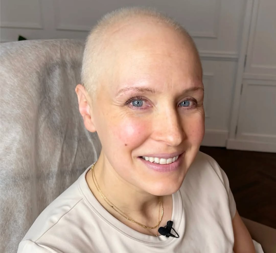 After Treatment