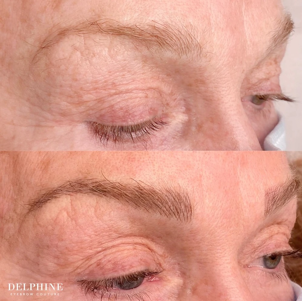 Eyebrow restoration before and after by Delphine