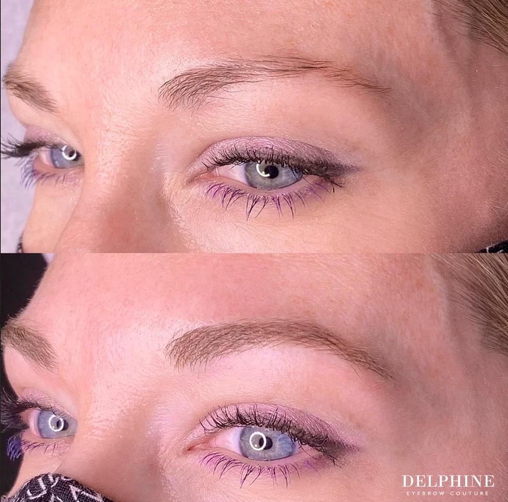 Eyebrow restoration before and after by Delphine