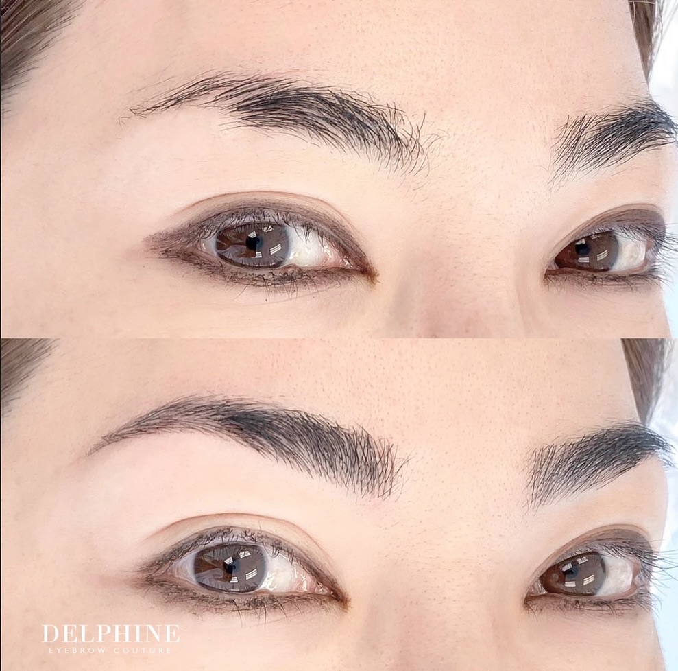 Eyebrow restoration before and after by Delphine