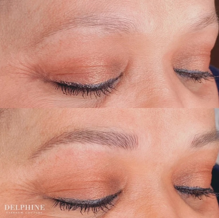 Eyebrow restoration before and after by Delphine