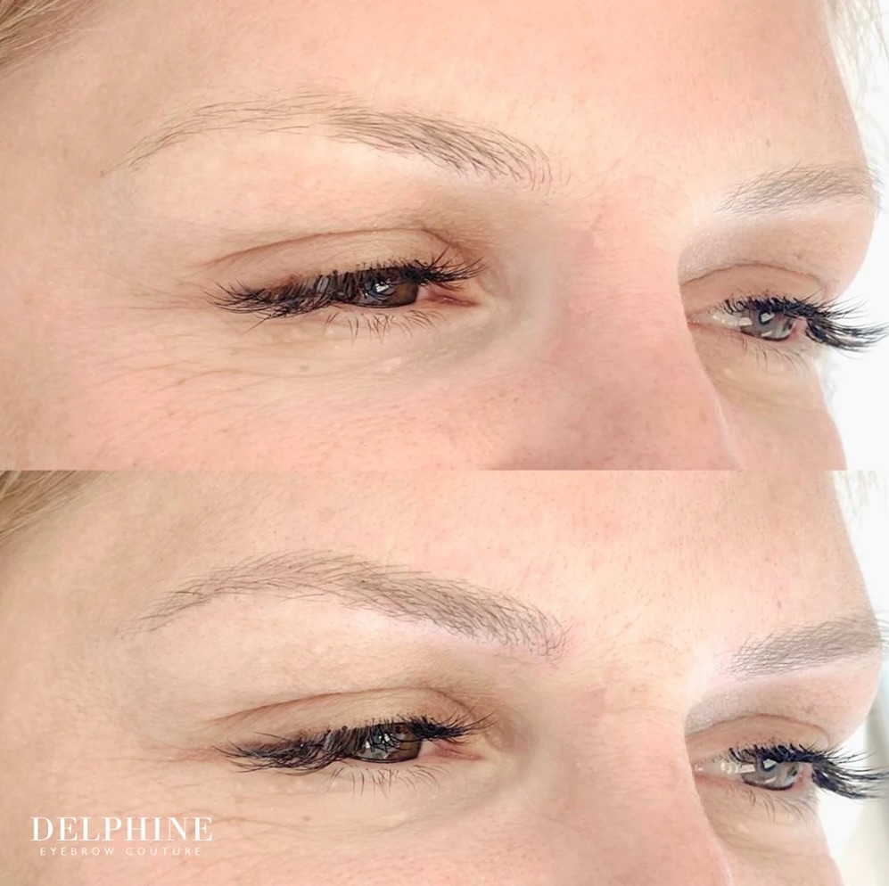 Eyebrow restoration before and after by Delphine