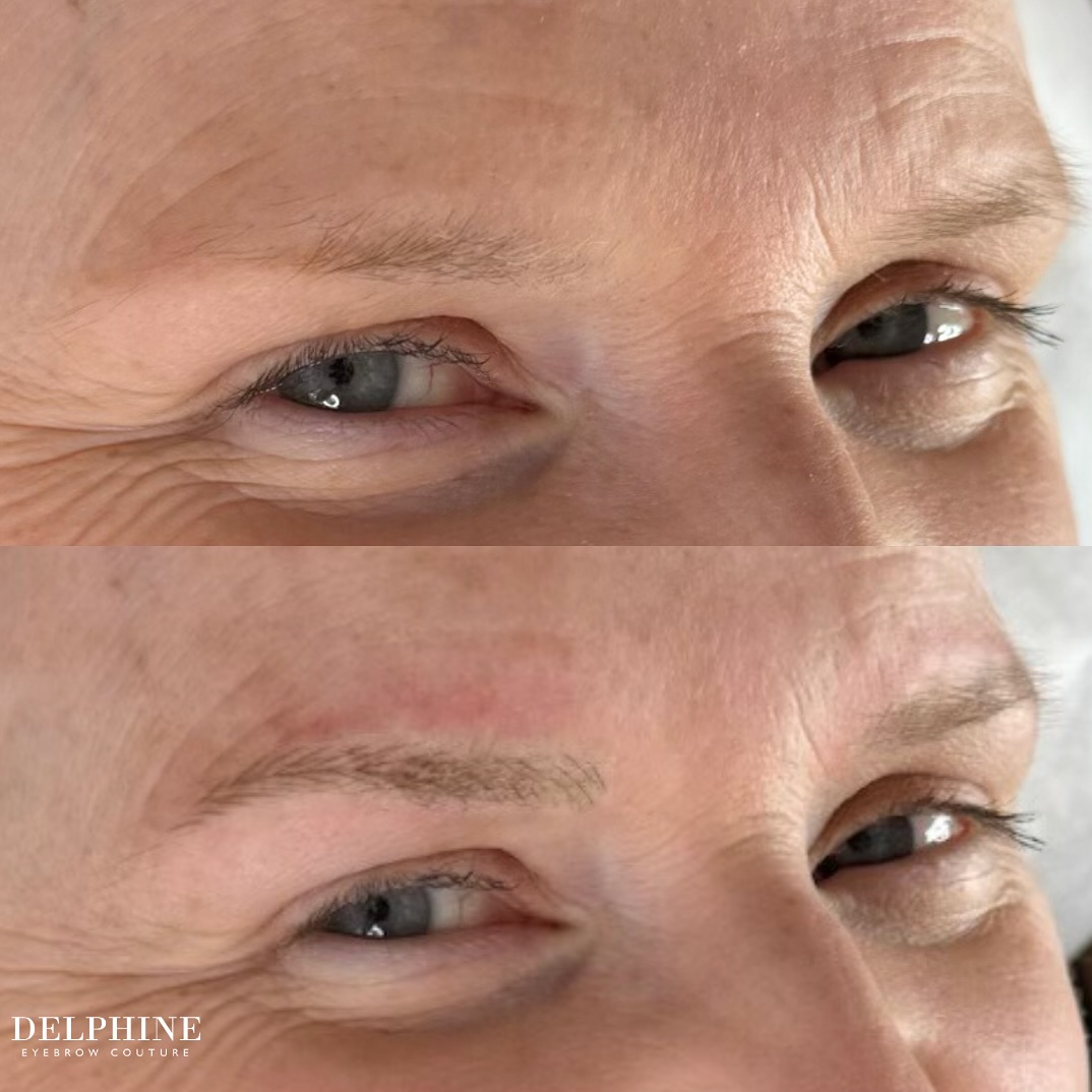 Eyebrow restoration before and after by Delphine