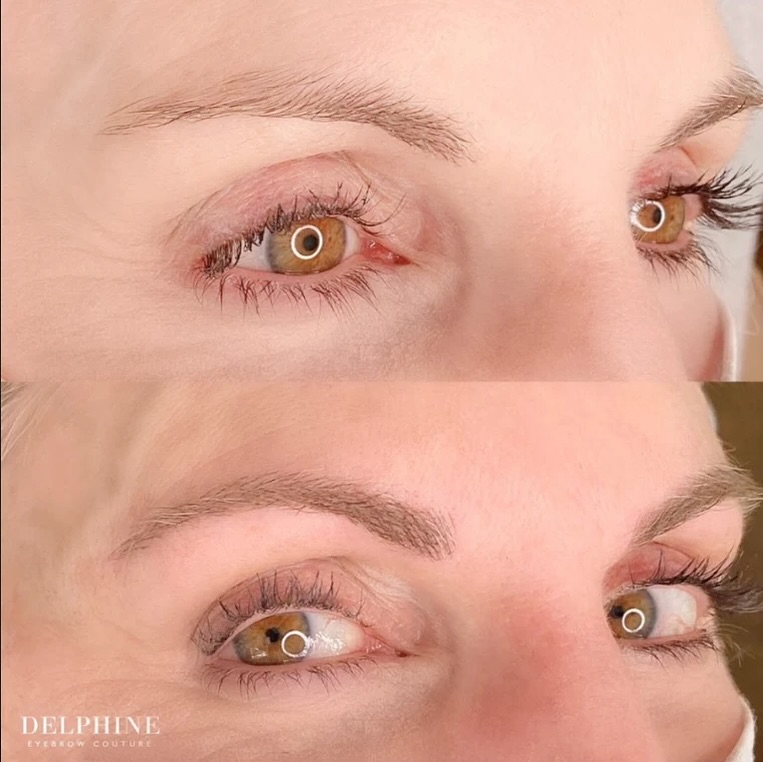 Eyebrow restoration before and after by Delphine