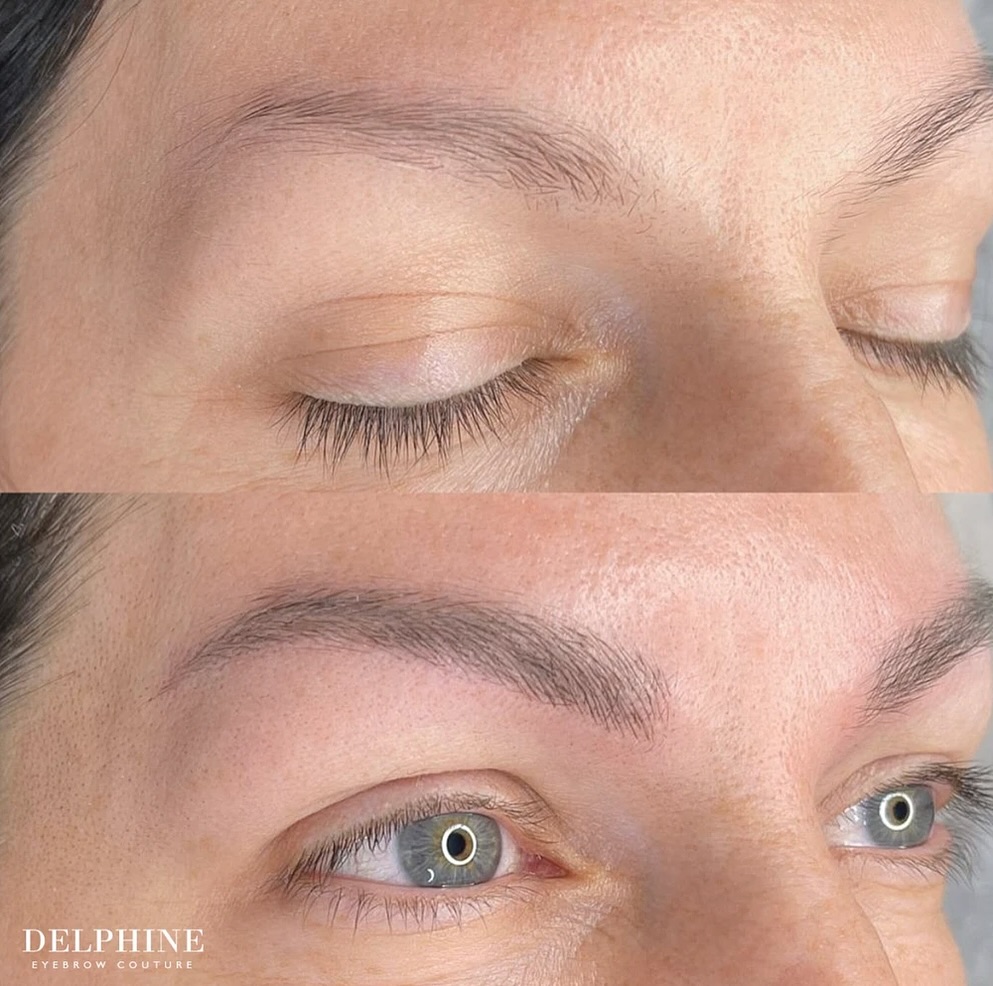 Eyebrow restoration before and after by Delphine