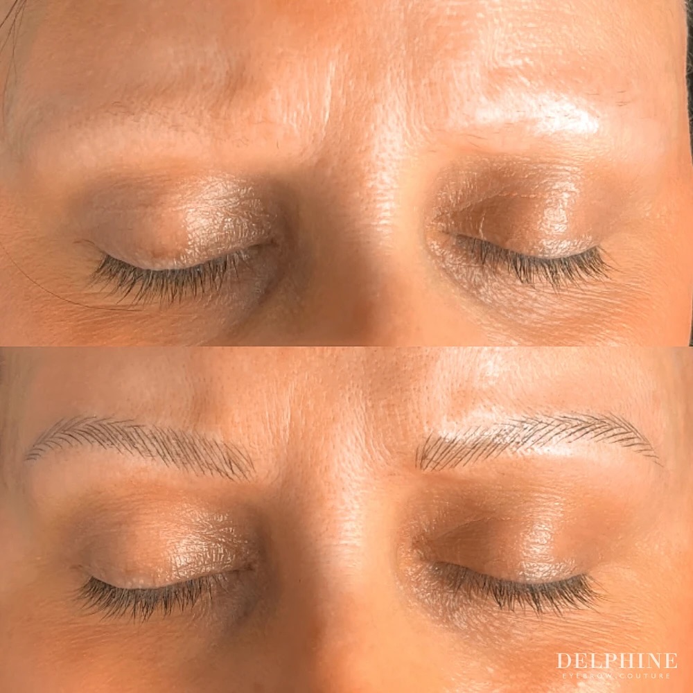 Eyebrow restoration before and after by Delphine