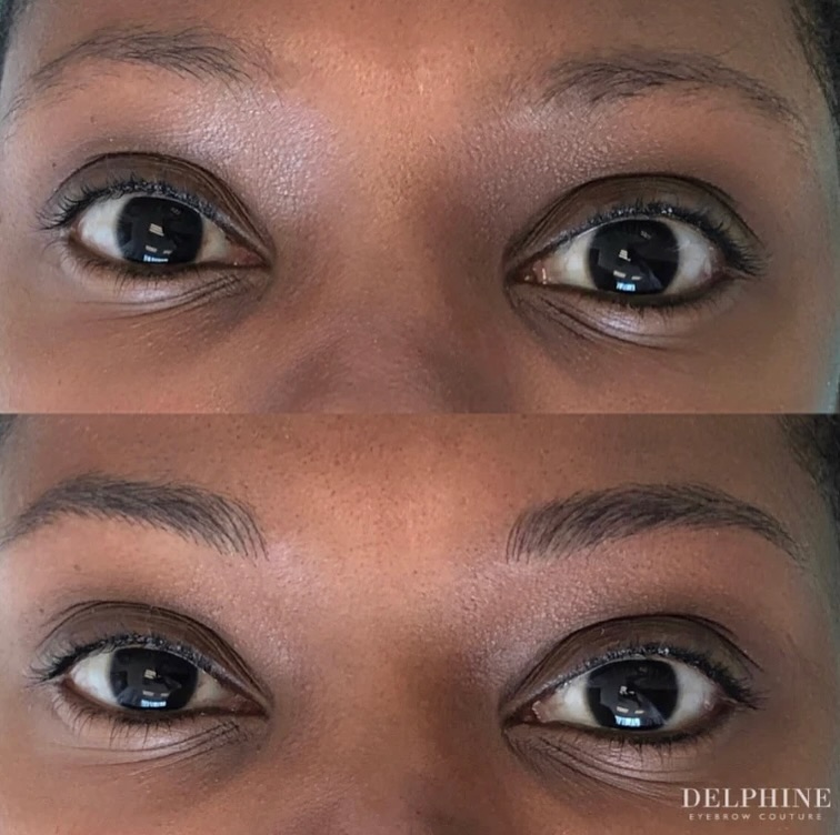 Eyebrow restoration before and after by Delphine