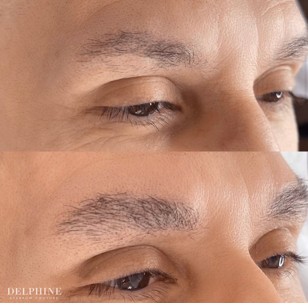 Eyebrow restoration before and after by Delphine
