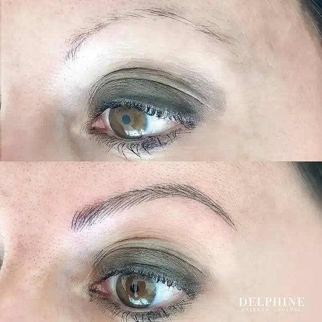 Eyebrow restoration before and after by Delphine