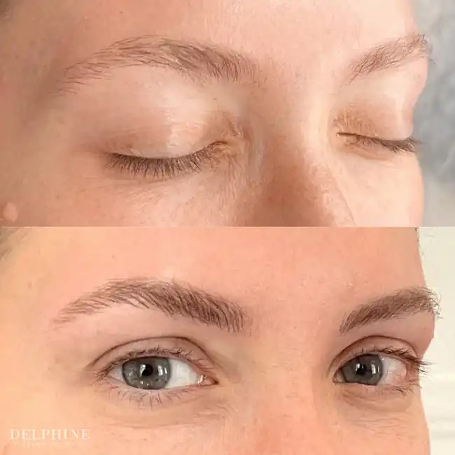 Eyebrow restoration before and after by Delphine