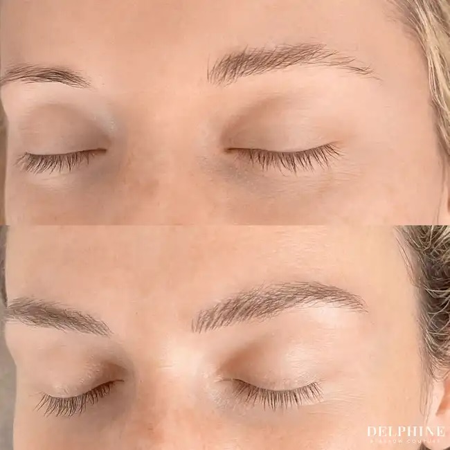 Eyebrow restoration before and after by Delphine