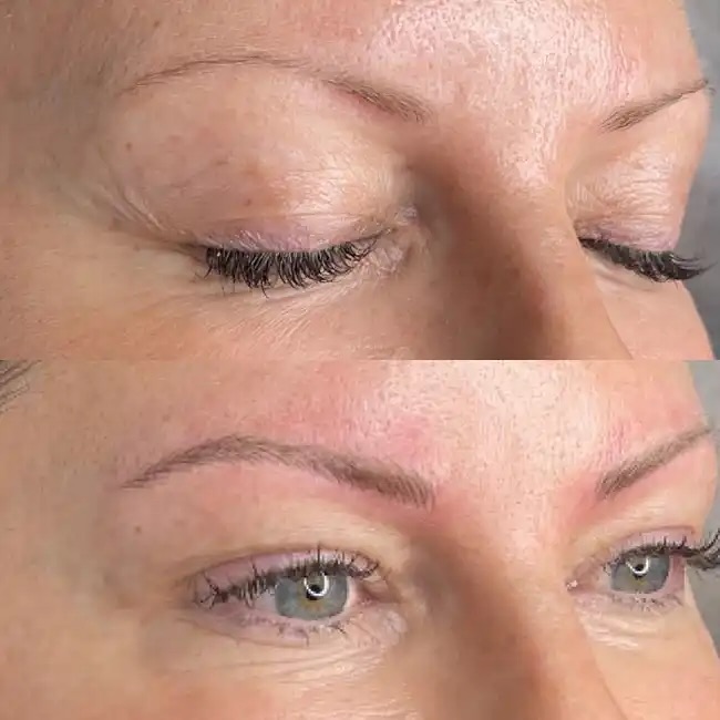 Eyebrow restoration before and after by Delphine
