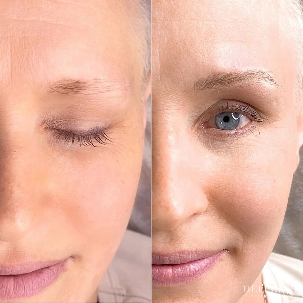 Eyebrow restoration before and after by Delphine