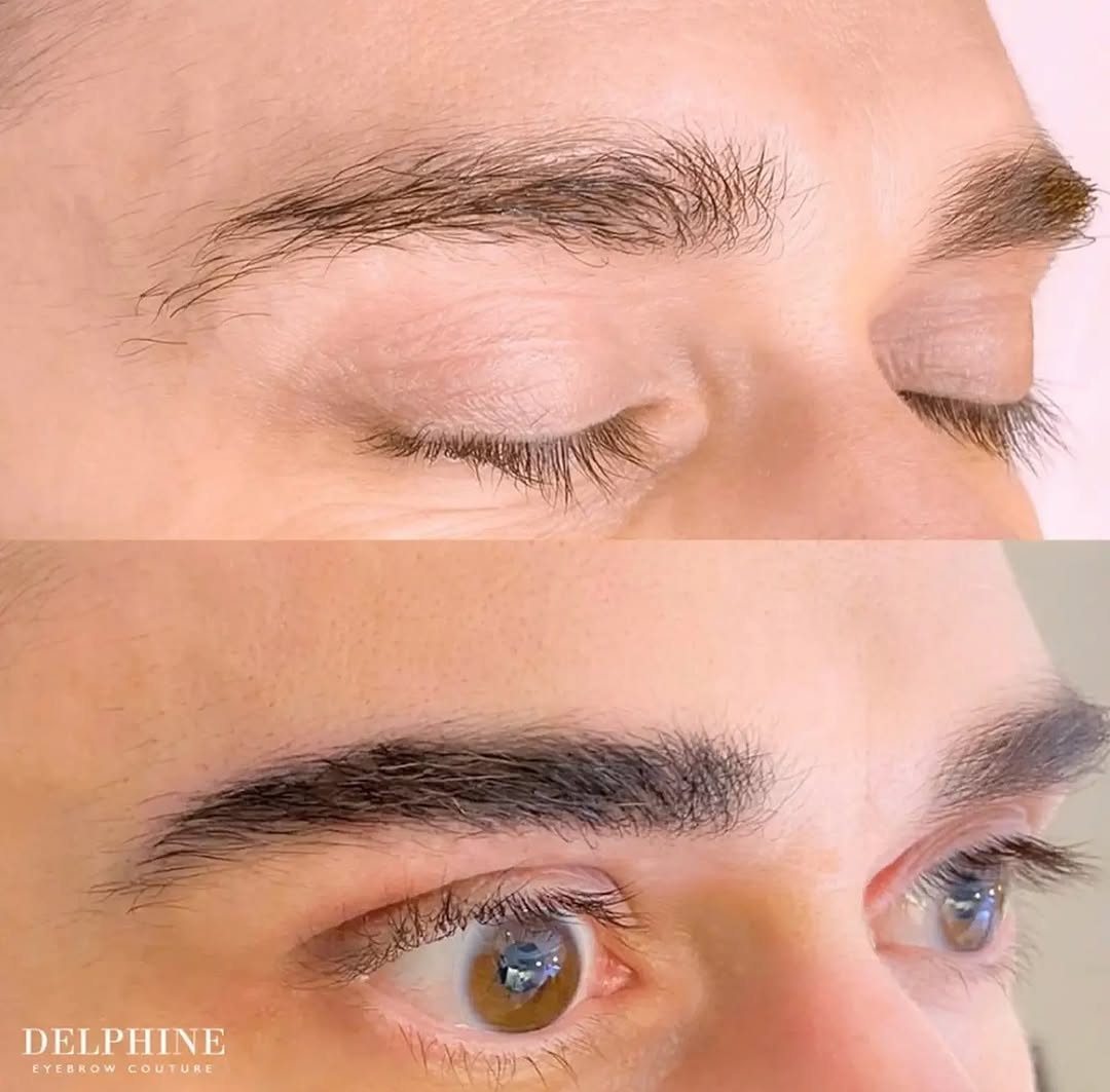 Eyebrow restoration before and after by Delphine