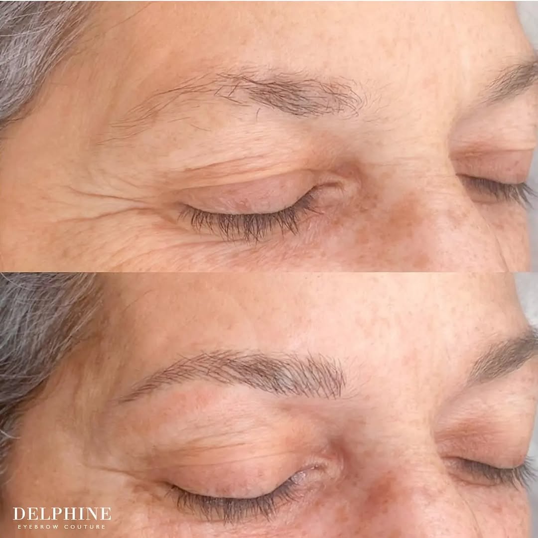 Eyebrow restoration before and after by Delphine